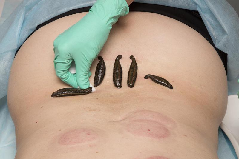 Strategie godowe pijawek