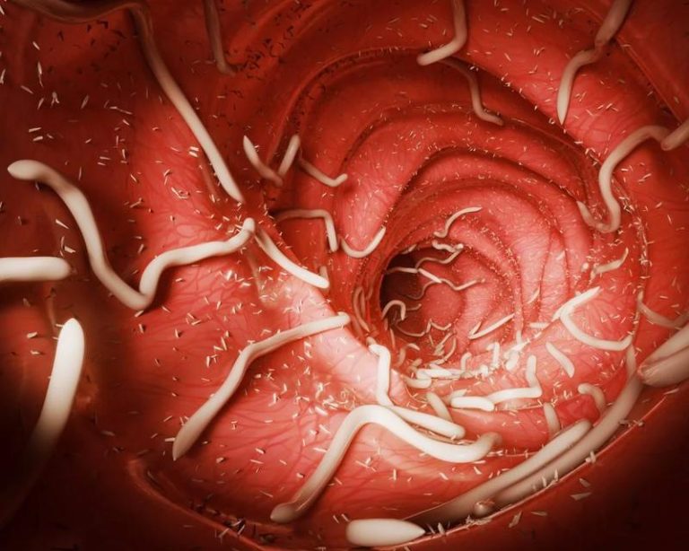 Jakie są nawyki żywieniowe glisty ludzkiej i jej wpływ na zdrowie człowieka?